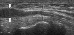 Musculoskeletal Ultrasound