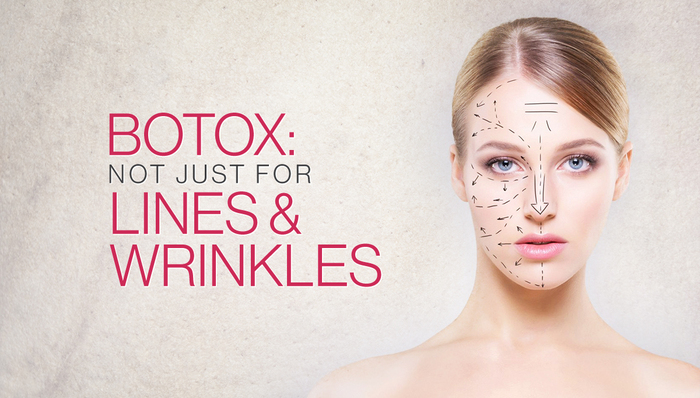 botox- not just for lines and wrinkles