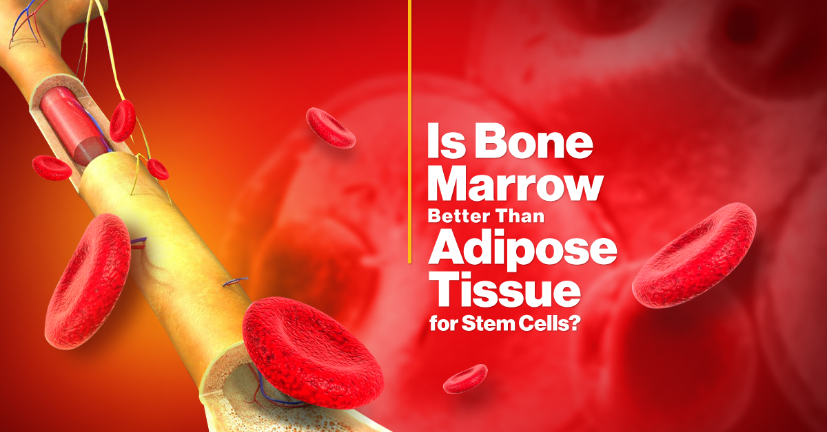 Is Bone Marrow better than Adipose Tissue for Stem Cells?