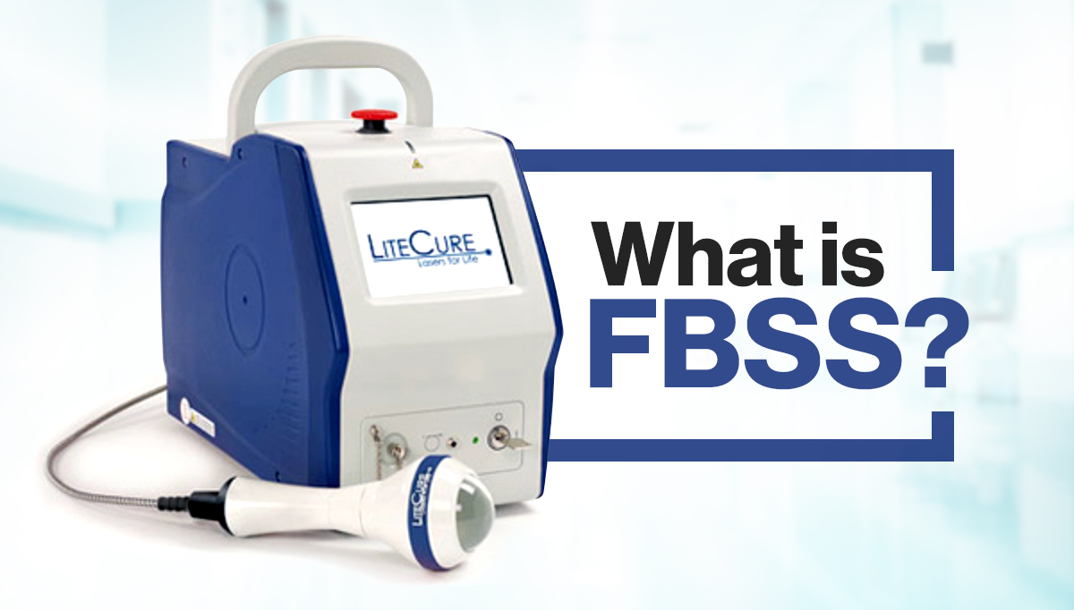 What is FBSS?