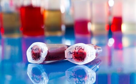 Blood samples in tube on table